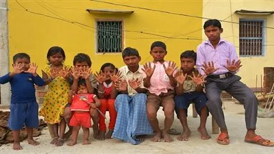 عائلة هندية بـ600 إصبع حيّرت العلماء! (صور)