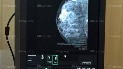 عبدالناصر يعلن  تركيب جهاز 