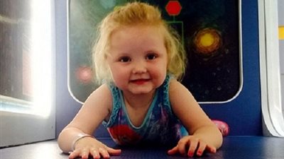 مرض غريب يفقد الطفلة 