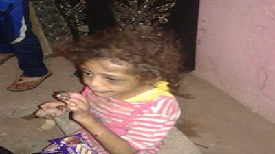 أب يحرق طفلته لأكلها طعام شقيقها في بني سويف
