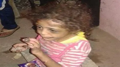 رجل مصري يُعذب طفلته حرقاً.. والسبب صادم!