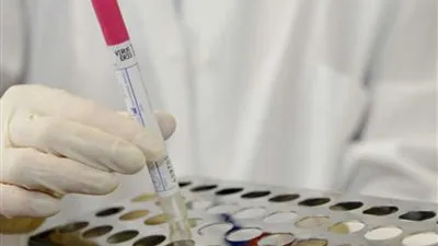 مستشفى عفيف يسجل حالة 