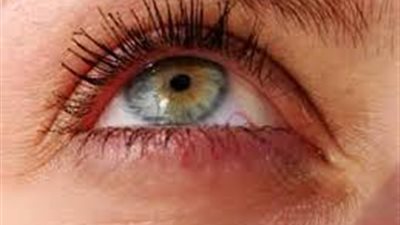 تعرفي على طرق سريعة لتخلص من انتفاخ الجفون !