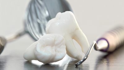 علماء تنصحك بالاحتفاظ بأسنان أطفالك اللبنية بعد سقوطها 