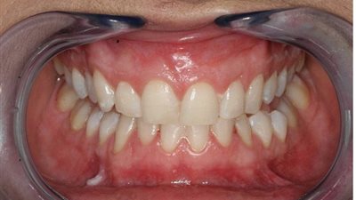 لهذه الاسباب تؤكد دراسة حديثة أن الفك البشري المُدمر الأكبر لكوكب الأرض !