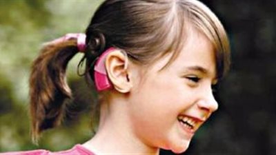 4 خطوات لإجراء عملية زراعة القوقعة فى أسرع وقت