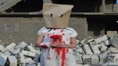 صاحبة صور أطفال حلب المفبركة تروي تفاصيل الواقعة 