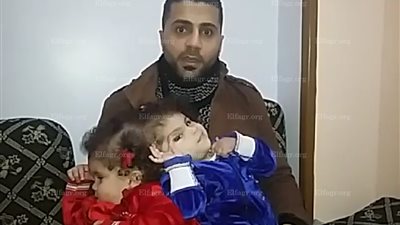 والد التوأم الملتصق: خادم الحرمين كتب حياه جديدة لبناتي.. ويكشف كواليس مكالمة رئيس مركز الملك سلمان للإغاثته (فيديو)