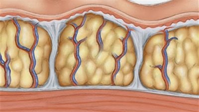 علماء يحذرون: الدهون تساهم في تشكيل الأورام الخبيثة