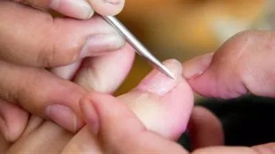 الباديكير فى مراكز التجميل يصيب السيدات بفيروس سى