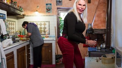 أنفق أمواله على عمليات التجميل فكانت النتيجة صادمة ومُرعبة !