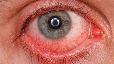 أكتشف أسباب علاج 