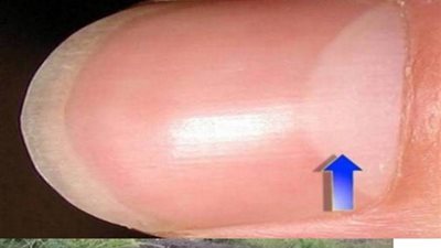 علامَ يدل الهلال الصغير على اظافرك !