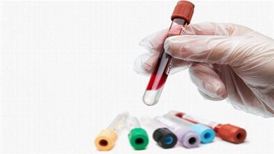 لائحة بأهم الفحوصات الروتينية لصحة الرجل