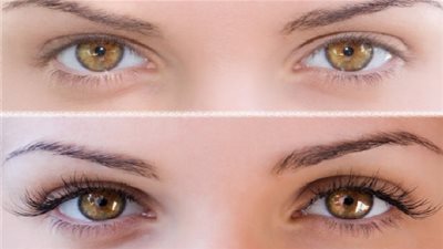 تخلصي من انتفاخ العينين بهذه الوصفة الطبيعية