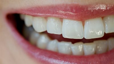 في دقيقة واحدة.. تعرفي كيف تحمي أسنانك من التآكل !