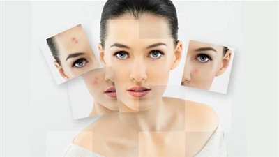 وصفة مذهلة تخلصك من حب الشباب في 3 أيام قبل زفافك