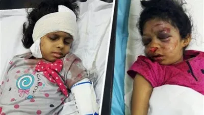 خادمة تضرب رأسي طفلتين في الجدار وتعتدي على الأم بشكل وحشي !