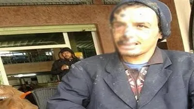 شاب مغربي يعاني من مرض 