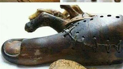 قدماء المصريين أول من ابتكر طرف صناعى فى التاريخ 