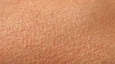 10 أخطاء شائعة نرتكبها تصيب بالأمراض الجلدية