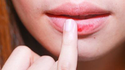 ماذا يحدث إذا دلكتِ شفتيكِ بكيس الشاي لمدة 5 دقائق ؟