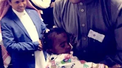 إعادة السمع لطفلين في مستشفى الملك سلمان في الرياض