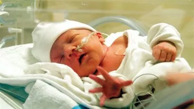 دراسة.. الأطفال المبتسرون يتعرضون لمخاطر نفسية