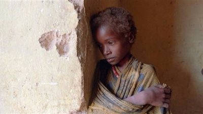 اليونيسف: 1.4 مليون طفل مهددون بالموت 