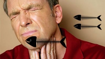 كيف تزيل شوك السمك من الحلق بسهولة؟