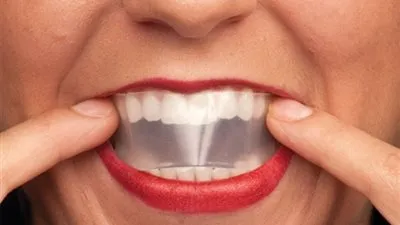 شاهد...أسرع طريقة لتبيض الأسنان في دقيقتين (فيديو)