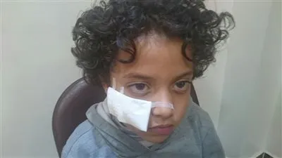 ولى أمر طالب أُصيب بعاهة مستديمة يحرر محضرًا ضد مدرسة خاصة بالسويس