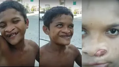 شاهد.. طفل يخرج لسانه من أنفه بطريقة غريبة ! (فيديو)