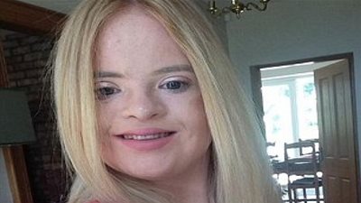 مصابة بمتلازمة داون تصبح أول 