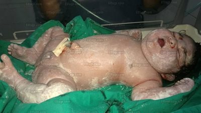 انفراد.. سيدة تلد طفل 9 كيلو في الإسماعيلية (صور)