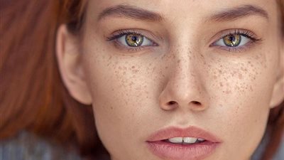 كيفية التخلص من النمش نهائيًا؟ (فيديو)