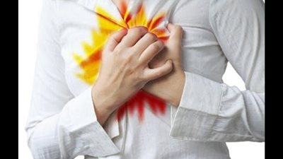 أغذية طبيعية تخلصك من حرقة المعدة.. تعرف عليها