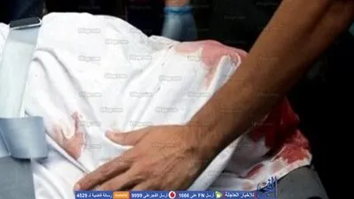 جوز الشغالة طلقها وخد المسروقات.. كشف غموض مقتل طبيبة سبعينية 