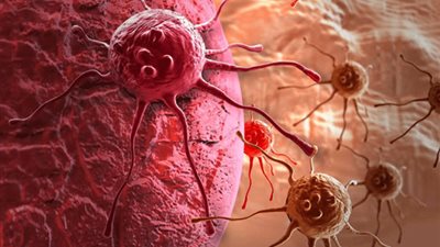 نصائح تجنبك الإصابة بـ السرطان