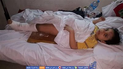 سقوط طالبة من أعلى سور مدرسة بالإسماعيلية