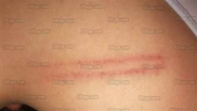 مُعلمة تعتدي على طفل بمدرسة بشبرا الخيمة.. والتعليم: 