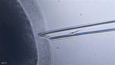 تسجيل أول حالة حمل من نوعها في التاريخ بجنوب أفريقيا 