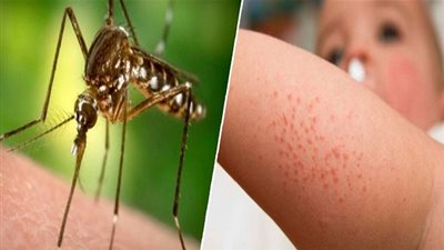 أول إصابة مؤكدة بفيروس حمى غرب النيل في ولاية مدنين‎