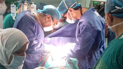 تفاصيل أول عملية في مصر لتغيير صمام القلب دون جراحة