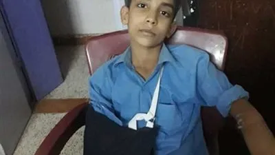 ولي أمر يتهم مدرسًا بـ«كسر ذراع» نجله في المنيا