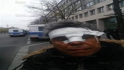 الاعتداء على رئيس الجالية المصرية بألمانيا أمام فندق إقامة 