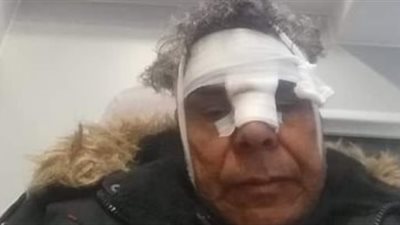 بعد الاعتداء عليه من الإخوان.. رئيس الجالية المصرية في ألمانيا: 