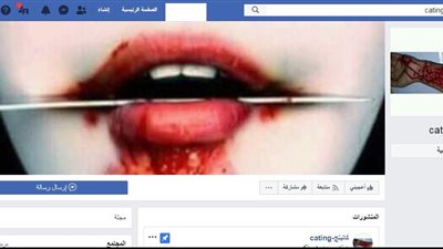 تقليدًا لحالات الانتحار.. طالبات تجرحن أيديهن بـ