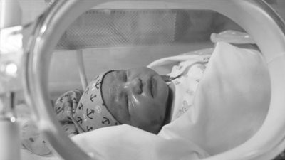 ما المقصود بالطفل المبتسر؟