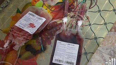 شاهد.. ضبط معمل تحاليل طبية يقوم بالإتجار في الدم بالشرقية (صور)